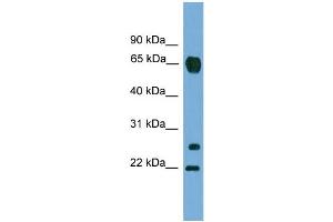 WB Suggested Anti-MMP26  Antibody Titration: 0. (MMP26 anticorps  (C-Term))