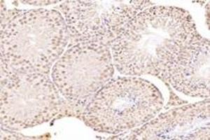 Immunohistochemistry analysis of paraffin-embedded mouse testis using,MED3 (ABIN7074581) at dilution of 1: 7200