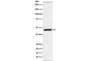 Western blot analysis of TMEFF2 expression in LnCaP cell lysate.