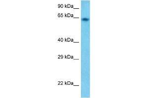 Host:  Rabbit  Target Name:  GUCY1B3  Sample Tissue:  Human HepG2 Whole cell  Antibody Dilution:  1ug/ml (GUCY1B3 anticorps)