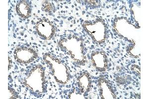 UBE2J1 antibody was used for immunohistochemistry at a concentration of 4-8 ug/ml to stain Alveolar cells (arrows) in Human Lung.