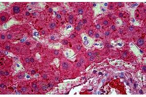 Human Liver: Formalin-Fixed, Paraffin-Embedded (FFPE) (APOA2 anticorps)
