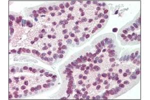 Immunohistochemistry (IHC) image for anti-X-Box Binding Protein 1 (XBP1) (AA 2-160) antibody (ABIN492538) (XBP1 anticorps  (AA 2-160))