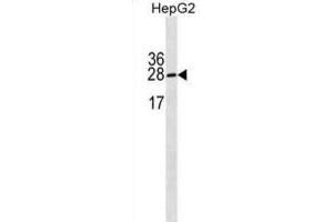 Western Blotting (WB) image for anti-Immunoglobulin lambda-Like Polypeptide 5 (IGLL5) antibody (ABIN3000244) (IGLL5 anticorps)