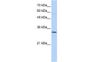 WB Suggested Anti-SFXN1 Antibody Titration:  0. (SFXN1 anticorps  (N-Term))