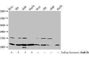Western Blot Detected samples: Hela whole cell lysate, 293 whole cell lysate, A549 whole cell lysate, HepG2 whole cell lysate, Untreated (-) or treated (+) with 30 mM sodium butyrate for 4h All lanes: HIST1H4A antibody at 1:100 Secondary Goat polyclonal to rabbit IgG at 1/50000 dilution Predicted band size: 12 kDa Observed band size: 12 kDa