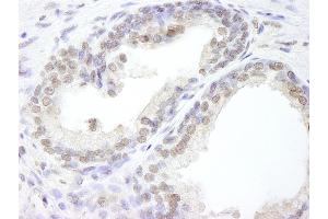 Immunohistochemistry (IHC) image for anti-Ubiquitin Specific Peptidase 47 (USP47) (C-Term) antibody (ABIN7449031) (USP47 anticorps  (C-Term))