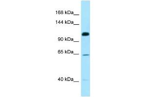 WB Suggested Anti-SMC6 Antibody Titration: 1. (SMC6 anticorps  (C-Term))