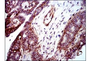 Immunohistochemistry (IHC) image for anti-Integrin beta 1 (ITGB1) antibody (ABIN1844058) (ITGB1 anticorps)