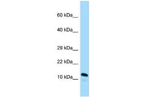 WB Suggested Anti-Arl2bp Antibody Titration: 1. (ARL2BP anticorps  (C-Term))