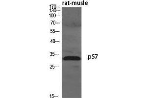 Western Blot (WB) analysis of specific cells using p57 Polyclonal Antibody. (P57 (N-Term) anticorps)