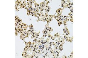 Immunohistochemistry of paraffin-embedded rat lung using ZNF408 antibody (ABIN5974874) at dilution of 1/100 (40x lens). (ZNF408 anticorps)