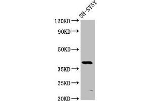 Western Blot Positive WB detected in: SH-SY5Y whole cell lysate All lanes: MKX antibody at 6 μg/mL Secondary Goat polyclonal to rabbit IgG at 1/50000 dilution Predicted band size: 40 kDa Observed band size: 40 kDa (MKX anticorps  (AA 157-305))