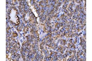 IHC analysis of ERP29 using anti-ERP29 antibody (ABIN7601342).