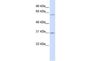 WB Suggested Anti-TMEM106C Antibody Titration:  0. (TMEM106C anticorps  (Middle Region))