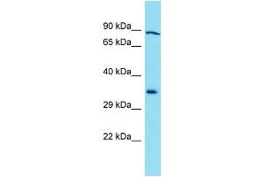 Western Blotting (WB) image for anti-Galactosidase, beta 1-Like 3 (GLB1L3) (C-Term) antibody (ABIN2791555) (GLB1L3 anticorps  (C-Term))