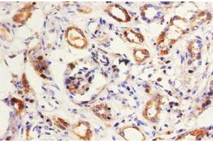 Immunohistochemistry of paraffin-embedded human kidney tissue using ABIN7157681 at dilution of 1:50 (KNG1 anticorps  (AA 390-644))