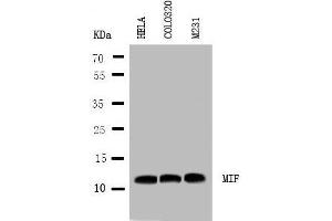 Anti-MIF antibody, Western blotting Lane 1: HELA Cell Lysate Lane 2: COLO320 Cell Lysate Lane 3: MM231 Cell Lysate