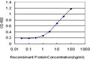 Detection limit for recombinant GST tagged IRAK3 is approximately 0. (IRAK3 anticorps  (AA 497-596))