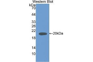Detection of Recombinant IL18, Rat using Polyclonal Antibody to Interleukin 18 (IL18) (IL-18 anticorps  (AA 37-194))