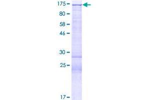 Image no. 1 for Histone Deacetylase 4 (HDAC4) (AA 1-972) protein (GST tag) (ABIN1306452)
