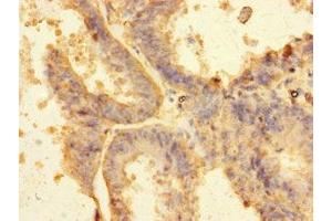 Immunohistochemistry of paraffin-embedded human endometrial tissue using ABIN7151123 at dilution of 1:100 (RNF13 anticorps  (AA 432-685))