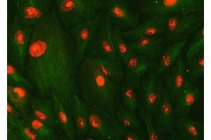 IF analysis of SMC1A and Tubulin beta using anti-SMC1A antibody (ABIN7602089) and anti-Tubulin beta antibody (ABIN7602744). (SMC1A anticorps  (AA 59-1233))