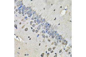 Immunohistochemistry of paraffin-embedded rat brain using MYH1 Antibody.