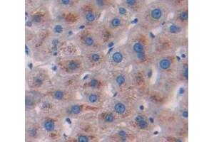 IHC-P analysis of Human Tissue, with DAB staining. (Glucuronidase beta anticorps  (AA 451-649))