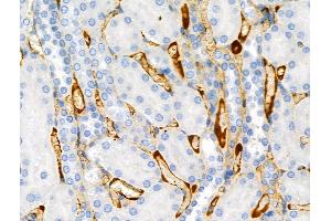 Phospho-SIRT2 (Ser368) Antibody at 1/100 staining Rat kidney tissue by IHC-P. (SIRT2 anticorps  (pSer368))
