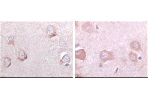 Immunohistochemical analysis of paraffin-embedded human cerebrum tissues using SORL1 mouse mAb with DAB staining.