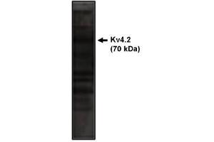 Image no. 1 for anti-Potassium Voltage-Gated Channel, Shal-Related Subfamily, Member 2 (KCND2) antibody (ABIN265029) (KCND2 anticorps)