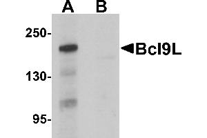 Western blot analysis of Bcl9L in HeLa cell lysate with Bcl9L antibody at 1 µg/mL in (A) the absence and (B) the presence of blocking peptide. (BCL9L anticorps  (N-Term))