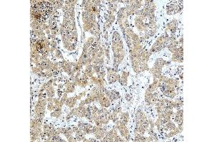 IHC analysis of ZWINT using anti-ZWINT antibody (ABIN4886776).