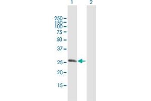 Western Blot analysis of RGS20 expression in transfected 293T cell line by RGS20 MaxPab polyclonal antibody.