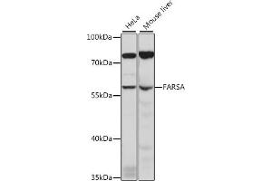 Western blot analysis of extracts of various cell lines, using FARSA antibody (ABIN7269266) at 1:1000 dilution.