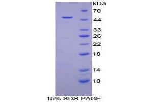SDS-PAGE (SDS) image for Myoglobin (MB) (AA 1-154) protein (His tag,GST tag) (ABIN1821599)