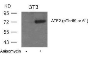 Image no. 3 for anti-Activating Transcription Factor 2 (ATF2) (pThr51), (pThr69) antibody (ABIN196664) (ATF2 anticorps  (pThr51, pThr69))