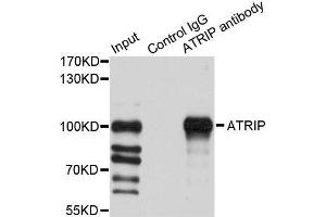 Immunoprecipitation analysis of 200ug extracts of HeLa cells using 1ug ATRIP antibody. (ATRIP anticorps  (AA 1-260))