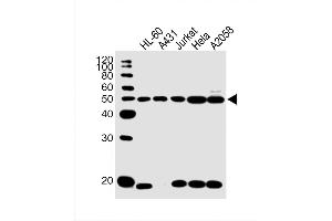 Western Blot at 1:1000 dilution Lane 1: HL-60 whole cell lysate Lane 2: A431 whole cell lysate Lane 3: Jurkat whole cell lysate Lane 4: Hela whole cell lysate Lane 5: A2058 whole cell lysate Lysates/proteins at 20 ug per lane. (Cytokeratin 28 anticorps  (C-Term))