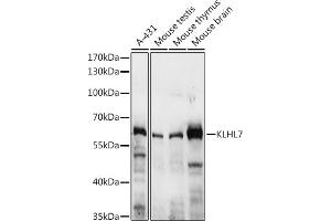 Western blot analysis of extracts of various cell lines, using KLHL7 antibody (ABIN7268080) at 1:3000 dilution.