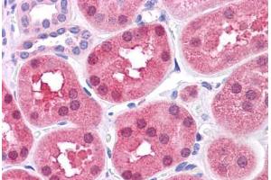 Human Kidney: Formalin-Fixed, Paraffin-Embedded (FFPE)