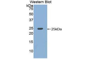 Western Blotting (WB) image for anti-KH Domain Containing, RNA Binding, Signal Transduction Associated 1 (KHDRBS1) (AA 156-381) antibody (ABIN1859527) (KHDRBS1 anticorps  (AA 156-381))