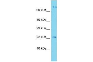 Host: Rabbit Target Name: APOPT1 Sample Type: Jurkat Whole Cell lysates Antibody Dilution: 1. (APOPT1 anticorps  (C-Term))