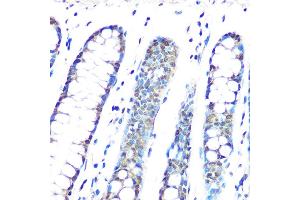 Immunohistochemistry of paraffin-embedded human colon using HP1 gamma/CBX3 Rabbit mAb (ABIN1679484, ABIN3018775, ABIN3018776 and ABIN7101659) at dilution of 1:100 (40x lens). (CBX3 anticorps)