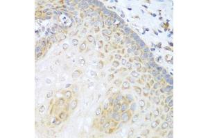 Immunohistochemistry of paraffin-embedded human esophagus using PRKCD antibody.