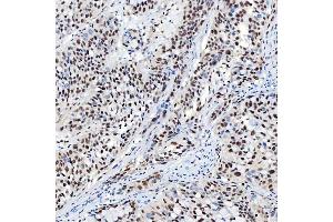 IHC analysis of SNRNP40 using anti-SNRNP40 antibody (ABIN7601719). (SNRNP40 anticorps  (AA 43-357))