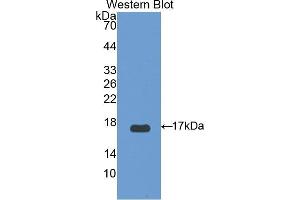 Western blot analysis of the recombinant protein. (UCP2 anticorps  (AA 154-289))