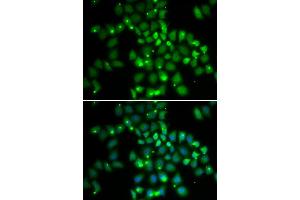 Immunofluorescence analysis of HeLa cell using PCGF6 antibody. (PCGF6 anticorps)