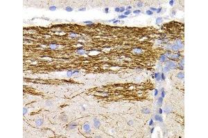 Immunohistochemistry of paraffin-embedded Rat brain using NEFL Polyclonal Antibody at dilution of 1:200 (40x lens). (NEFL anticorps)